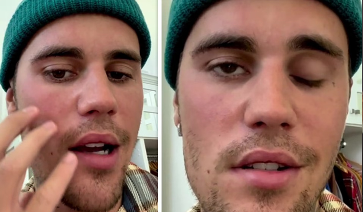 Justin Bieber